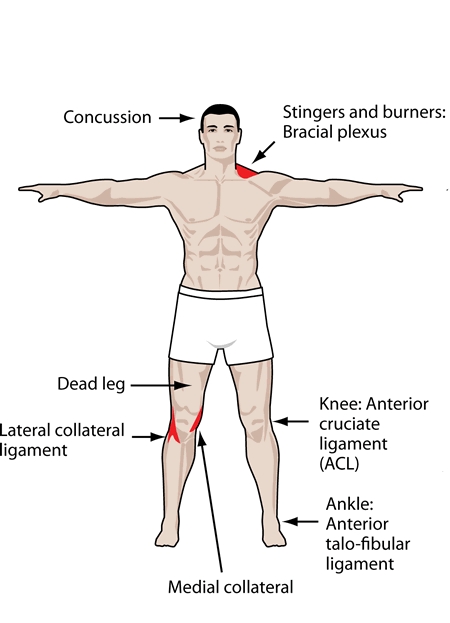 rugby coaching injuries
